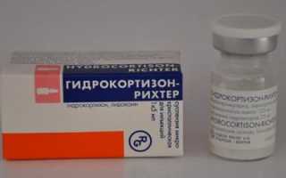 Лечить туннельный синдром народными средствами