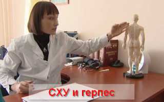 Вирус герпеса и синдром хронической усталости