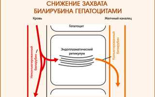 Как служить в армии с синдромом жильбера