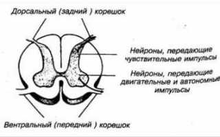 Полисегментарный остеохондроз позвоночника с корешковым синдромом