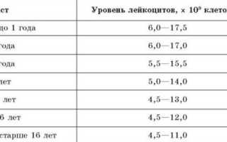 Код лейкоцитурии по мкб