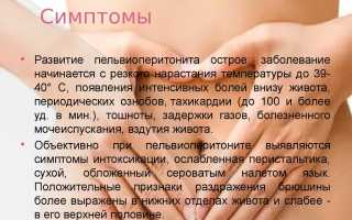 Острый живот симптомы и синдромы