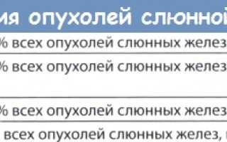 Плеоморфная аденома околоушной слюнной железы код мкб