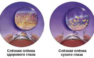 От чего бывает синдром сухого глаза