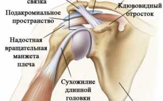 Синдром субакромиального конфликта плечевого сустава
