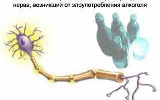 Нейропатия нерва код мкб