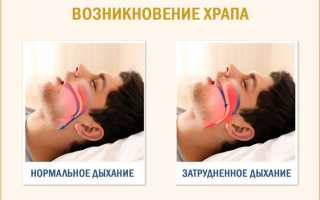 Соас синдром обструктивного апноэ сна