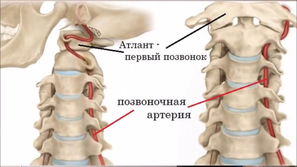 Позвоночные артерии