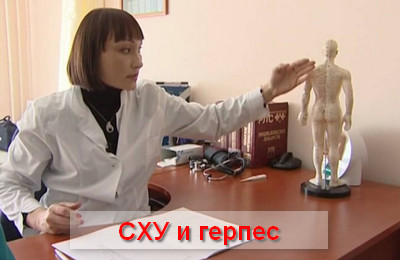СХУ и герпес