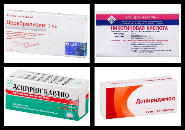 церебролизин, никотиновая кислота, аспирин кардио, дипиридамол