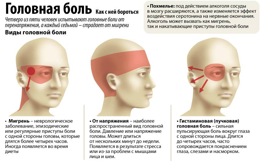 Головные боли