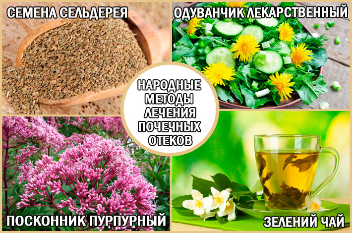 Почечные отеки: лечение отеков народными средствами