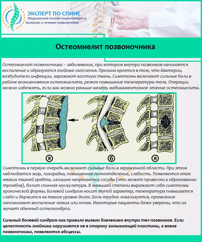 Остеомиелит позвоночника