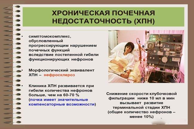 Почечная недостаточность