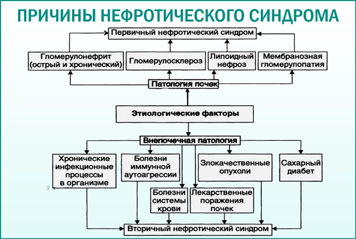 Нефротический синдром: причины