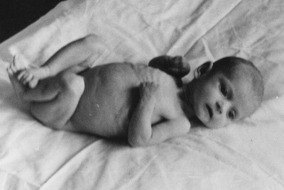 Недостаточность питания у детей в МКБ 10: Гипотрофия Недостаточность питания у детей в МКБ 10: Гипотрофия