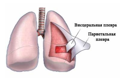 Плевра