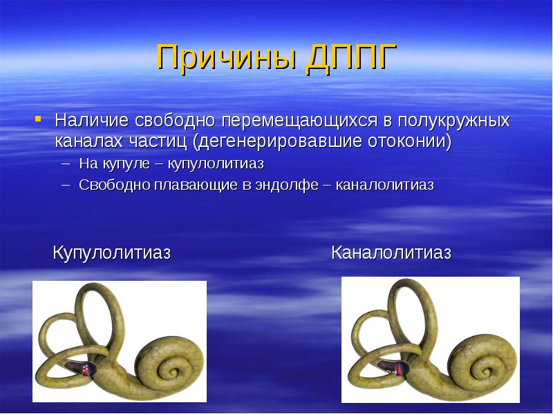 Доброкачественное позиционное головокружение