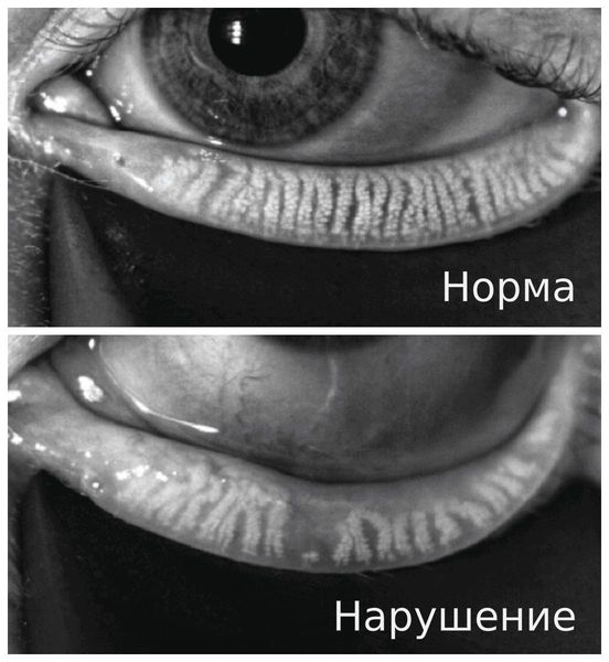 Результаты мейбографии