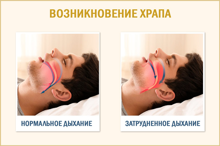 Затрудненное дыхание