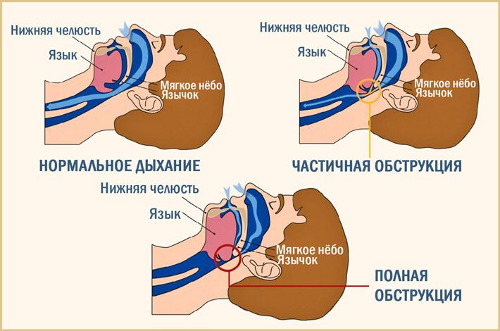 СОАС