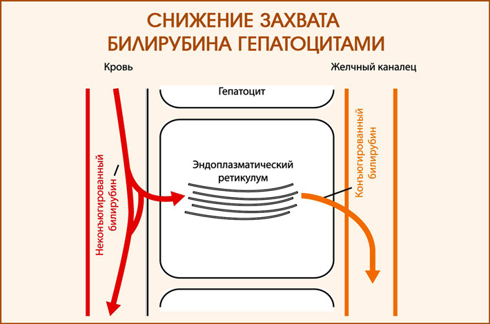 шаблон