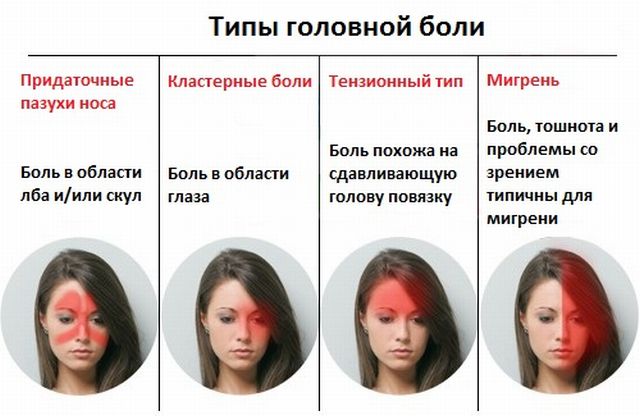 Типы головных болей