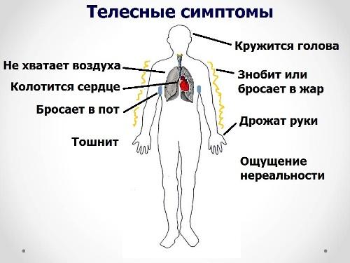 всд и цефалгия